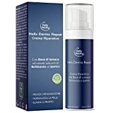 Crema Reparadora de Psoriasis con Baba de Caracol Echinacea Hipérico 100% Natural Dermatitis Eczema Elaborada...