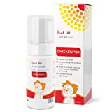 Poxclin Cool Mousse para Niños con Varicela 100ml