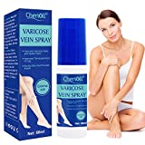 Spray para venas varicosas Venas pesadas Crema para venas varicosas, Reduce las venas varicosas Spray, 60ML