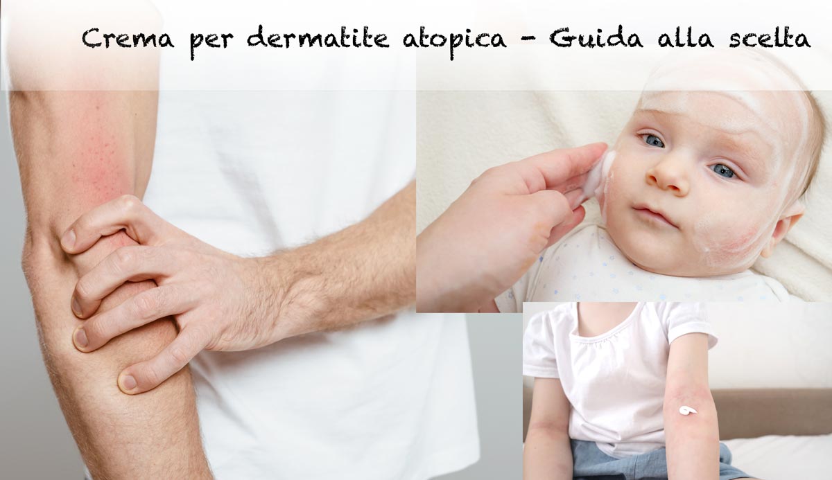 crema para dermatitis atópica