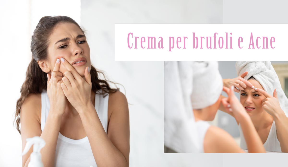 crema para espinillas y acne